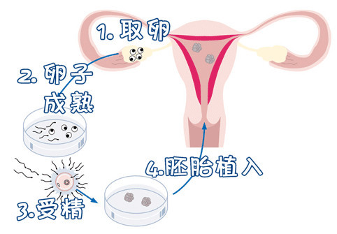 林主任